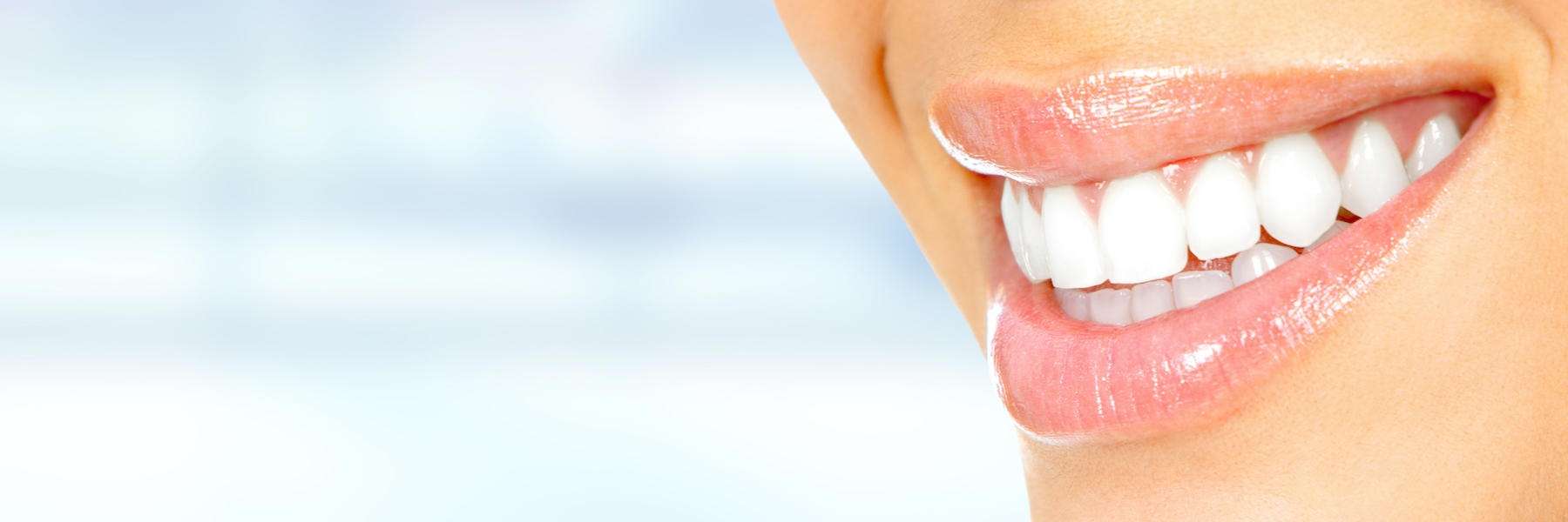 Porcelain Veneers | Dentist